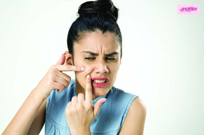 मुळापासून घालवा मुरूमांचे डाग