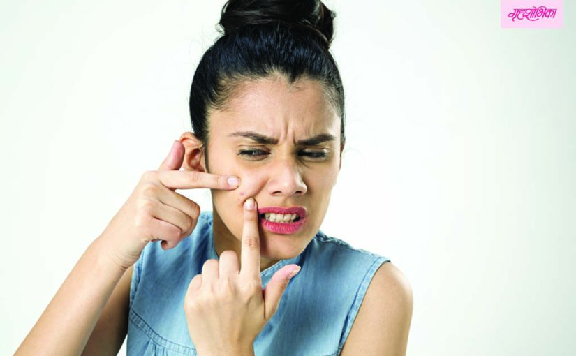 मुळापासून घालवा मुरूमांचे डाग